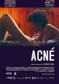 ~Acné海报,Acné预告片 -西班牙电影海报~